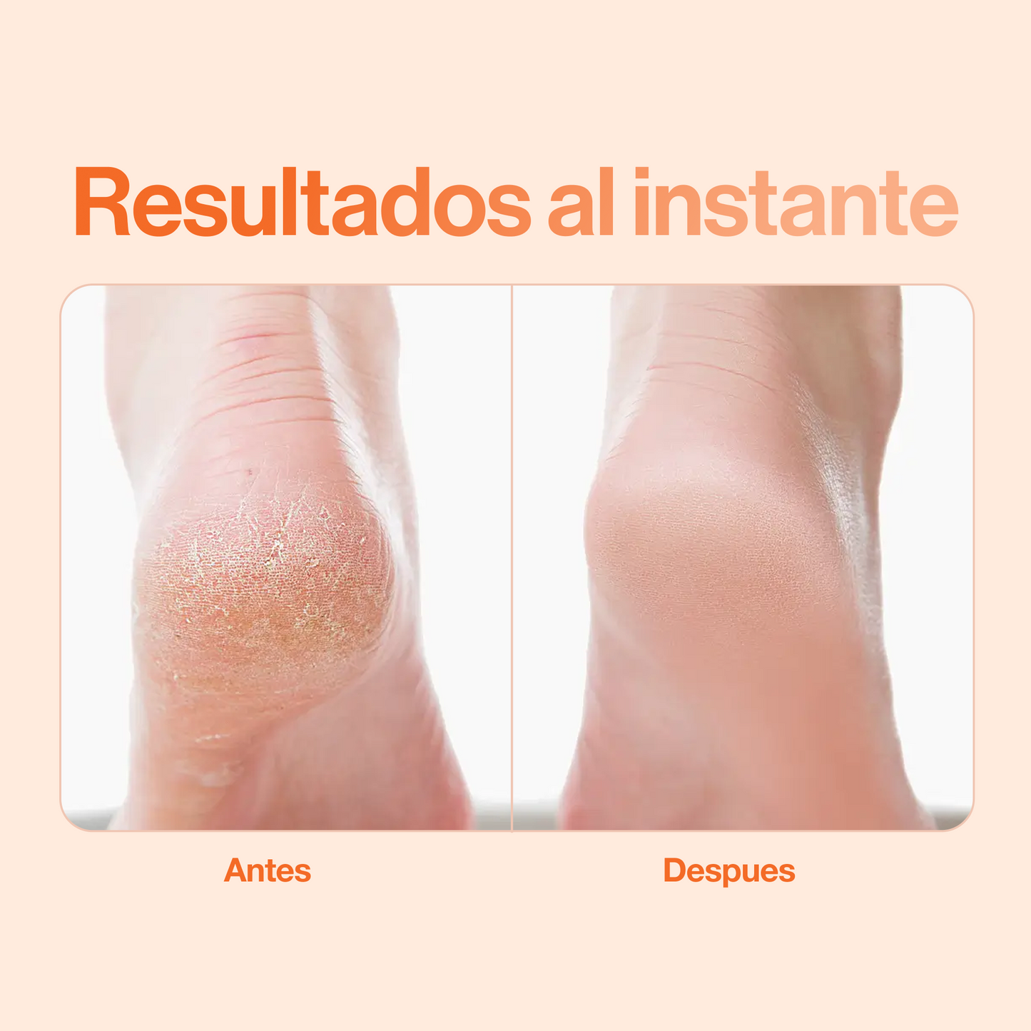 Limador de pies eléctrico
